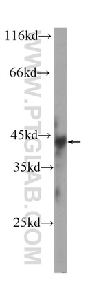 Chk1 Antibody in Western Blot (WB)