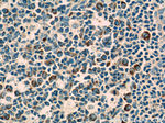 IL-19 Antibody in Immunohistochemistry (Paraffin) (IHC (P))