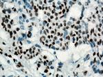 P53 Antibody in Immunohistochemistry (Paraffin) (IHC (P))