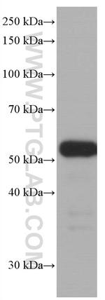 P53 Antibody in Western Blot (WB)