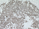 P53 Antibody in Immunohistochemistry (Paraffin) (IHC (P))