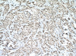 P53 Antibody in Immunohistochemistry (Paraffin) (IHC (P))