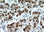 P53 Antibody in Immunohistochemistry (Paraffin) (IHC (P))