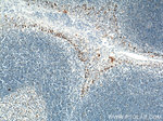 P53 Antibody in Immunohistochemistry (Paraffin) (IHC (P))