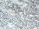 P53 Antibody in Immunohistochemistry (Paraffin) (IHC (P))