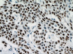 P53 Antibody in Immunohistochemistry (Paraffin) (IHC (P))