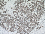 P53 Antibody in Immunohistochemistry (Paraffin) (IHC (P))