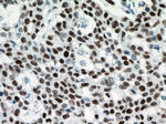 P53 Antibody in Immunohistochemistry (Paraffin) (IHC (P))