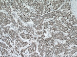 P53 Antibody in Immunohistochemistry (Paraffin) (IHC (P))