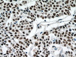 P53 Antibody in Immunohistochemistry (Paraffin) (IHC (P))