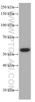 P53 Antibody in Western Blot (WB)