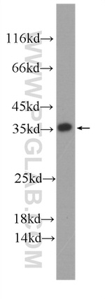 ATP5C1 Antibody in Western Blot (WB)