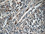 IL36 beta/IL1F8 Antibody in Immunohistochemistry (Paraffin) (IHC (P))