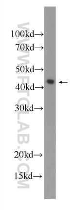 IL36 beta/IL1F8 Antibody in Western Blot (WB)