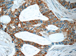 TNF alpha Antibody in Immunohistochemistry (Paraffin) (IHC (P))