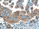 OPTN Antibody in Immunohistochemistry (Paraffin) (IHC (P))