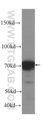 OPTN Antibody in Western Blot (WB)