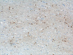 OPTN Antibody in Immunohistochemistry (Paraffin) (IHC (P))