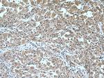 CYP2D6 Antibody in Immunohistochemistry (Paraffin) (IHC (P))