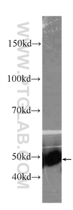 CYP2D6 Antibody in Western Blot (WB)