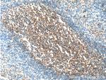 ICAM-1 Antibody in Immunohistochemistry (Paraffin) (IHC (P))