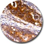 Ras Antibody in Immunohistochemistry (Paraffin) (IHC (P))