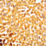 HBcAg Antibody in Immunohistochemistry (Paraffin) (IHC (P))