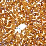 HBeAg Antibody in Immunohistochemistry (Paraffin) (IHC (P))