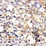 PRL b-subunit Antibody in Immunohistochemistry (Paraffin) (IHC (P))