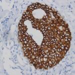 PSA Antibody in Immunohistochemistry (Paraffin) (IHC (P))