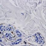 Tat epitope 2 Antibody in Immunohistochemistry (Paraffin) (IHC (P))