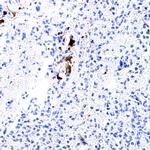 TSH b-subunit Antibody in Immunohistochemistry (Paraffin) (IHC (P))