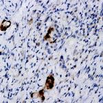 TSH b-subunit Antibody in Immunohistochemistry (Paraffin) (IHC (P))