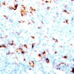 CD51 Antibody in Immunohistochemistry (Paraffin) (IHC (P))