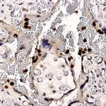 Uroplakin-2 Antibody in Immunohistochemistry (Paraffin) (IHC (P))