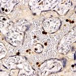 PDGF-A/B Antibody in Immunohistochemistry (Paraffin) (IHC (P))