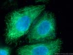 BID Antibody in Immunocytochemistry (ICC/IF)