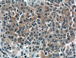 BID Antibody in Immunohistochemistry (Paraffin) (IHC (P))