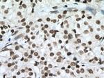 SIRT1 Antibody in Immunohistochemistry (Paraffin) (IHC (P))