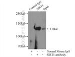 SIRT1 Antibody in Immunoprecipitation (IP)