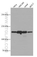 SIRT1 Antibody in Western Blot (WB)