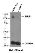 SIRT1 Antibody in Western Blot (WB)