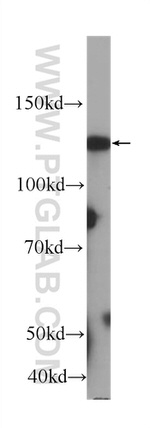 SIRT1 Antibody in Western Blot (WB)