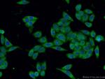 SGTA Antibody in Immunocytochemistry (ICC/IF)