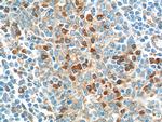 IL2 Antibody in Immunohistochemistry (Paraffin) (IHC (P))