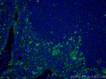 IL2 Antibody in Immunohistochemistry (PFA fixed) (IHC (PFA))