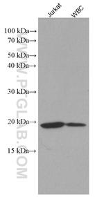 IL2 Antibody in Western Blot (WB)