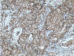 pan Ras Antibody in Immunohistochemistry (Paraffin) (IHC (P))