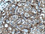 pan Ras Antibody in Immunohistochemistry (Paraffin) (IHC (P))