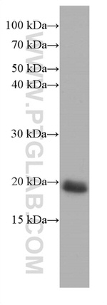 pan Ras Antibody in Western Blot (WB)